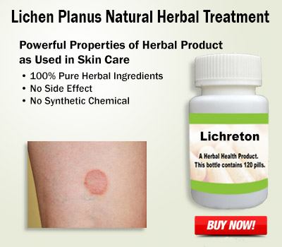 Natural Remedies for Lichen Planus Relieve the Pain Naturally